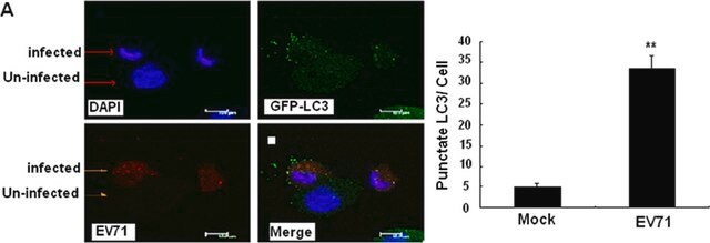 Anti-Enterovirus 71 Antibody, cross-reacts with Coxsackie A16, clone 422-8D-4C-4D ascites fluid, clone 422-8D-4C-4D, Chemicon&#174;