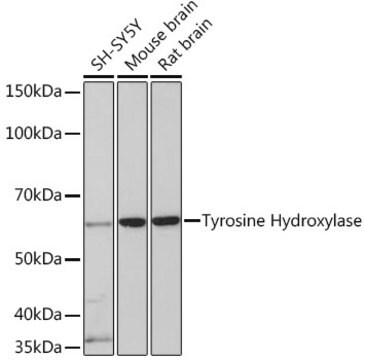 Anti-Tyrosine Hydroxylase Antibody, clone 0E9I7, Rabbit Monoclonal