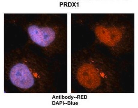 Anti-PRDX1 antibody produced in rabbit affinity isolated antibody