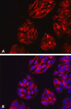 Anti-DPP4/CD26 antibody, Mouse monoclonal clone A6H, purified from hybridoma cell culture