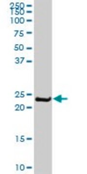 Anti-MYL6B antibody produced in rabbit purified immunoglobulin, buffered aqueous solution