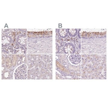 Anti-HEXB antibody produced in rabbit Prestige Antibodies&#174; Powered by Atlas Antibodies, affinity isolated antibody, buffered aqueous glycerol solution