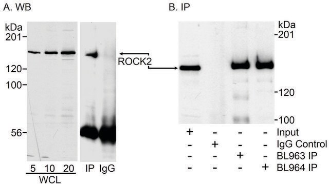 Rabbit anti-ROCK2 Antibody, Affinity Purified Powered by Bethyl Laboratories, Inc.