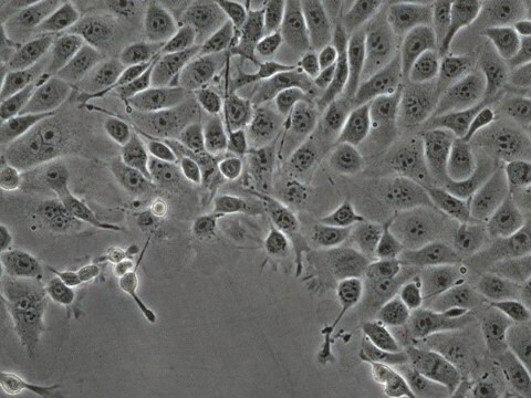 MOC2 Mouse Oral Squamous Cell Carcinoma (OSCC) Cell Line