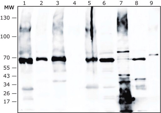 Przeciwciało anty-Enterococcusfaecalis wytwarzane u królika IgG fraction of antiserum