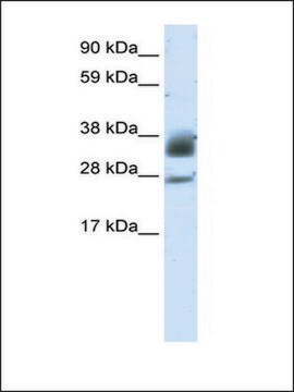 Anti-SIRT5 (AB2) antibody produced in rabbit IgG fraction of antiserum