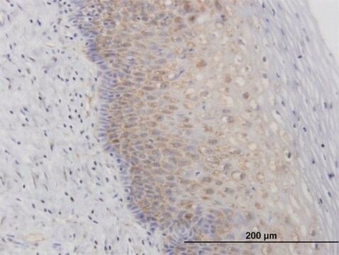 抗RPL29抗体 マウス宿主抗体 IgG fraction of antiserum, buffered aqueous solution