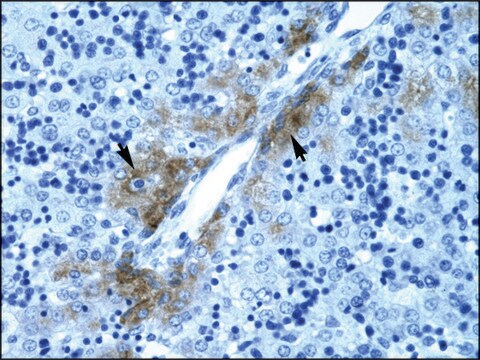 Anti-GATA3 antibody produced in rabbit affinity isolated antibody