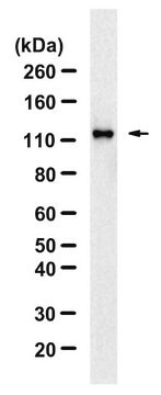 抗 phospho-ULK1-Ser757抗体 クローン5L18 ZooMAb&#174;ウサギモノクローナル recombinant, expressed in HEK 293 cells