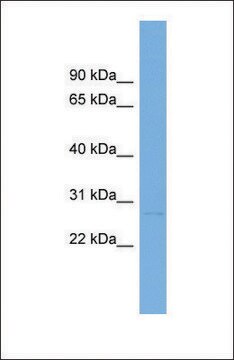 Anti-LTB antibody produced in rabbit affinity isolated antibody