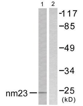 Anti-NM23 antibody produced in rabbit affinity isolated antibody