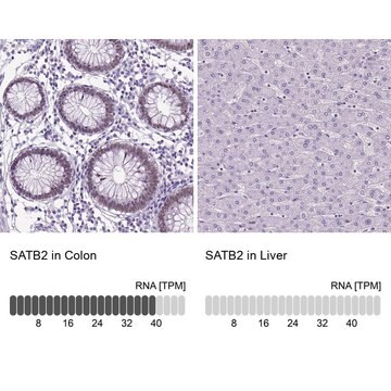 Anti-SATB2 antibody produced in rabbit Prestige Antibodies&#174; Powered by Atlas Antibodies, affinity isolated antibody, buffered aqueous glycerol solution