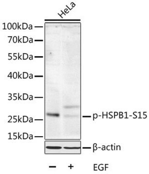 Anti-Phospho-HSPB1-S15 antibody produced in rabbit