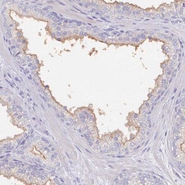 Anti-SLC44A4 antibody produced in rabbit Prestige Antibodies&#174; Powered by Atlas Antibodies, affinity isolated antibody, buffered aqueous glycerol solution