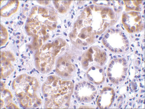 Anti-CTRP1 (ab2) antibody produced in rabbit affinity isolated antibody, buffered aqueous solution