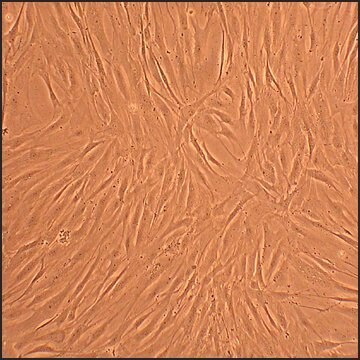 Human Osteoblasts-Rheumatoid Arthritis: HOb-RA, adult