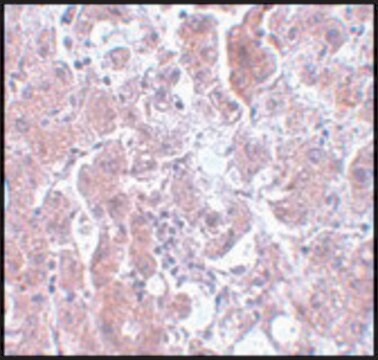 Anti-ELOVL7 antibody produced in rabbit affinity isolated antibody, buffered aqueous solution