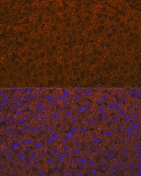 Anti-ADAMTS13 Antibody, clone 7B2Z8, Rabbit Monoclonal