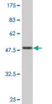 Monoclonal Anti-TAGLN antibody produced in mouse clone 1E2, purified immunoglobulin, buffered aqueous solution