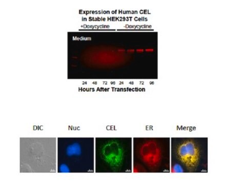 Anti-Bile salt-activated lipase Antibody serum, from rabbit