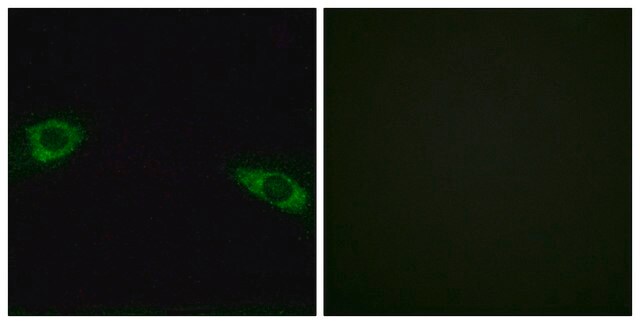 Anti-RPS4Y1 antibody produced in rabbit affinity isolated antibody