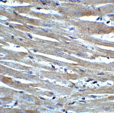 Anty-CX3CR1 affinity isolated antibody