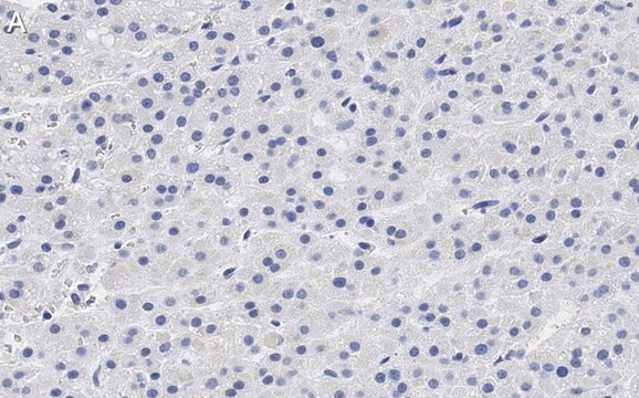 Anti-CXCR4 Antibody, clone 2L2, ZooMAb&#174; Rabbit Monoclonal recombinant, expressed in HEK 293 cells