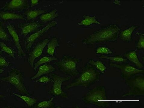 Anti-TPRKB antibody produced in rabbit purified immunoglobulin, buffered aqueous solution