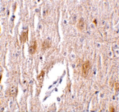 Anti-TRIM5 delta antibody produced in rabbit affinity isolated antibody