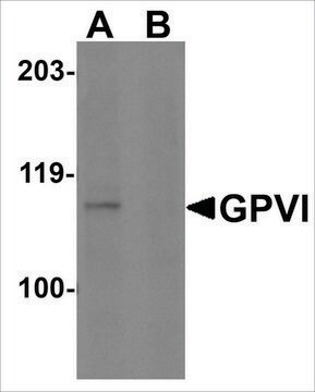 Anti-GPVI (ab2) antibody produced in rabbit affinity isolated antibody, buffered aqueous solution