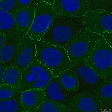 Anti-Desmoplakin Antibody, clone 20B6 clone 20B6, from mouse