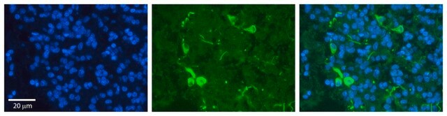 Anti-PRDX2 antibody produced in rabbit affinity isolated antibody