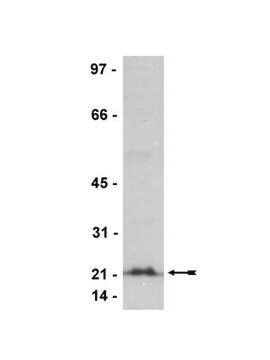 Przeciwciało anty-Rho (-A, -B, -C), klon 3L74, królicze monoklonalne clone 3L74, Upstate&#174;, from rabbit