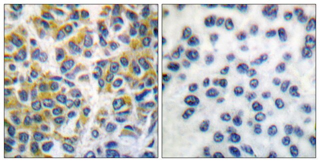 Anti-SHP-1 antibody produced in rabbit affinity isolated antibody