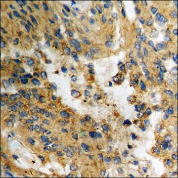 Anti-phospho-AKT1 (pThr308) antibody produced in rabbit affinity isolated antibody