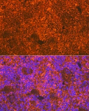 Anti-CD3D antibody produced in rabbit