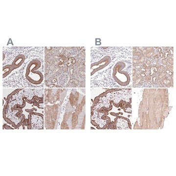 Anti-FCHO2 antibody produced in rabbit Prestige Antibodies&#174; Powered by Atlas Antibodies, affinity isolated antibody, buffered aqueous glycerol solution