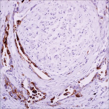 MUC4 (8G7) Mouse Monoclonal Antibody