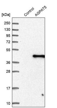 Anti-AGPAT5 antibody produced in rabbit Prestige Antibodies&#174; Powered by Atlas Antibodies, affinity isolated antibody, buffered aqueous glycerol solution