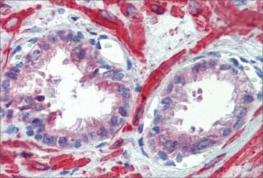 Anti-IGFBP4 antibody produced in rabbit affinity isolated antibody