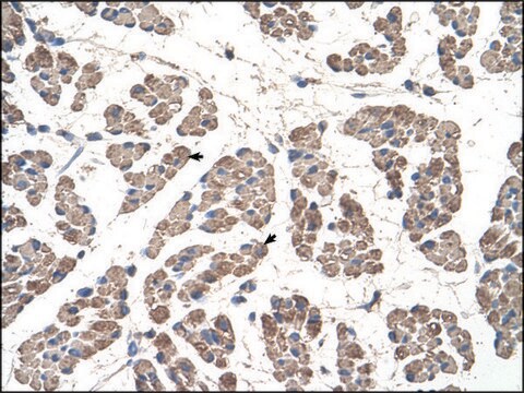 Anti-GCDH antibody produced in rabbit IgG fraction of antiserum