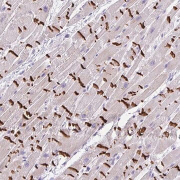 Anti-SLC16A6 antibody produced in rabbit Prestige Antibodies&#174; Powered by Atlas Antibodies, affinity isolated antibody, buffered aqueous glycerol solution