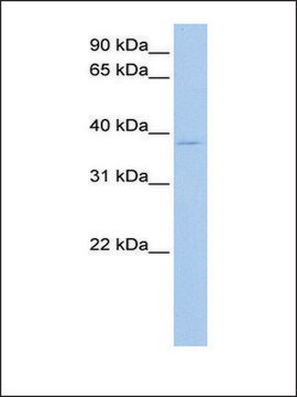 Anti-RPL3 antibody produced in rabbit affinity isolated antibody