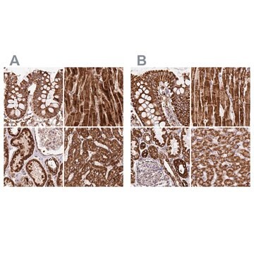 Anti-ATP5A1 antibody produced in rabbit Prestige Antibodies&#174; Powered by Atlas Antibodies, affinity isolated antibody, buffered aqueous glycerol solution