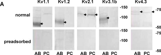 Przeciwciało przeciwko kanałowi potasowemu Kv1.1 Chemicon&#174;, from rabbit