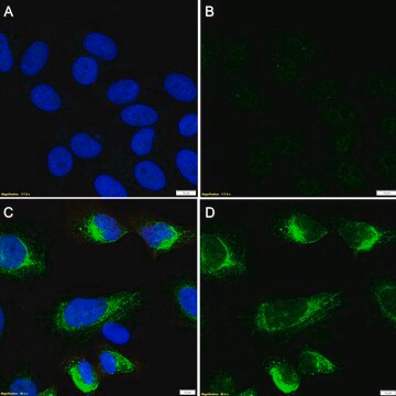 Anti-RFP/DsRed Antibody, clone 1E11 ZooMAb&#174; Rabbit Monoclonal recombinant, expressed in HEK 293 cells