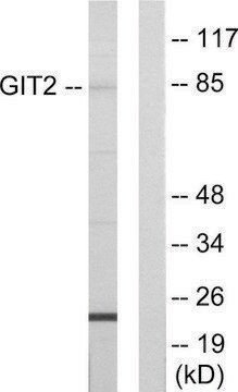 Anti-GIT2 antibody produced in rabbit affinity isolated antibody