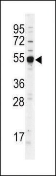 ANTI-DNMT2 antibody produced in rabbit IgG fraction of antiserum, buffered aqueous solution