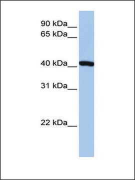 抗FTSJ1抗体 ウサギ宿主抗体 affinity isolated antibody