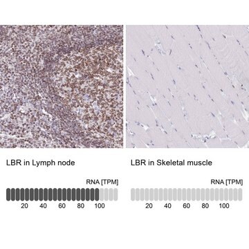 抗LBR抗体 ウサギ宿主抗体 Prestige Antibodies&#174; Powered by Atlas Antibodies, affinity isolated antibody, buffered aqueous glycerol solution